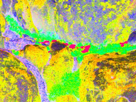 Sonnenflecken - Kunstdruck - Kristin Gräfin von Montfort - Array auf - Array - Sonnenflecken - Kunstdruck - Kristin Gräfin von Montfort - Array auf - Array -